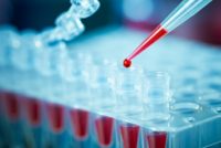 pcr analysis dna profiling