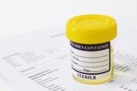 drug testing